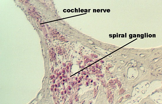 cochlear_nerve1.jpg (69929 bytes)