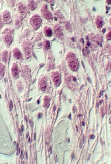 spiral_ganglion3.jpg (78963 bytes)