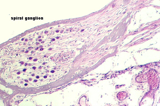 spiral_ganglion4.jpg (76115 bytes)
