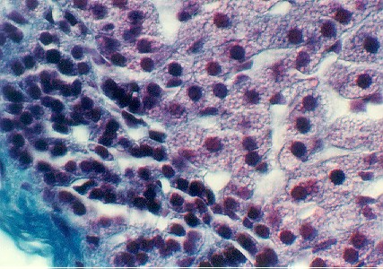 adrenal4.jpg (71205 bytes)