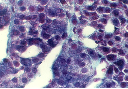 adrenal8.jpg (64414 bytes)