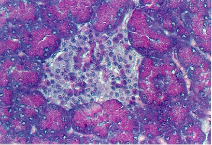 pancreas1.jpg (83347 bytes)