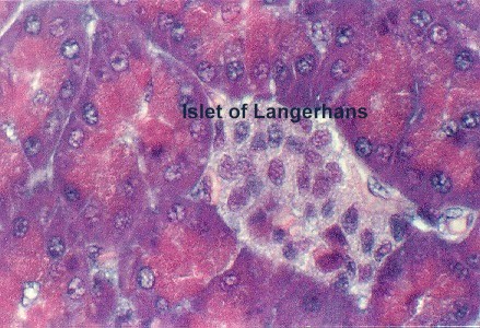 pancreas2.jpg (69626 bytes)
