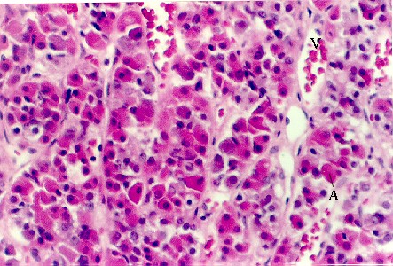 pit2.jpg (77197 bytes)