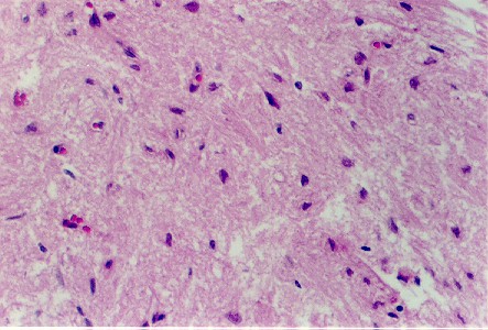 pit4.jpg (57630 bytes)