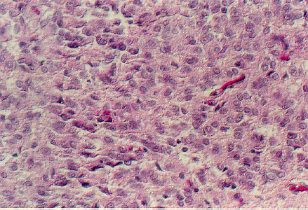 ypineal1.jpg (83269 bytes)