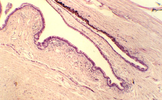 conjunctiva1.jpg (67035 bytes)