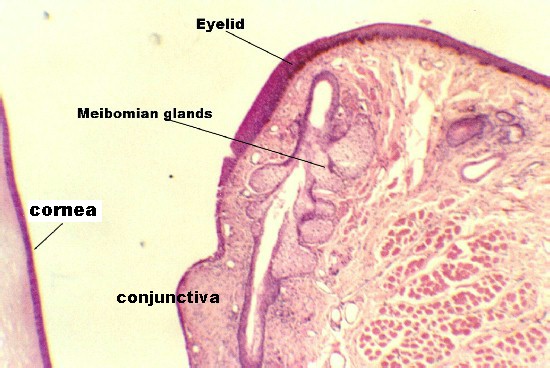 eyelid2.jpg (62882 bytes)
