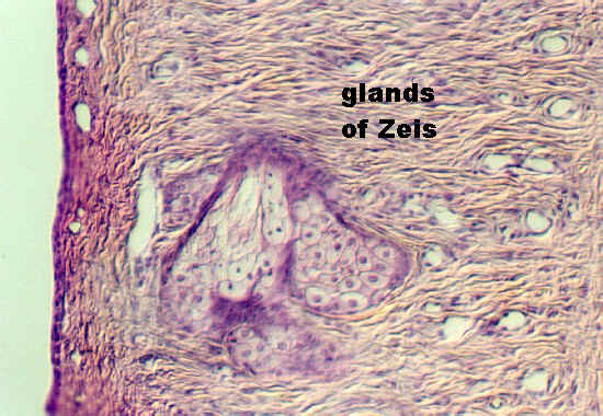 eyelid4.jpg (99399 bytes)