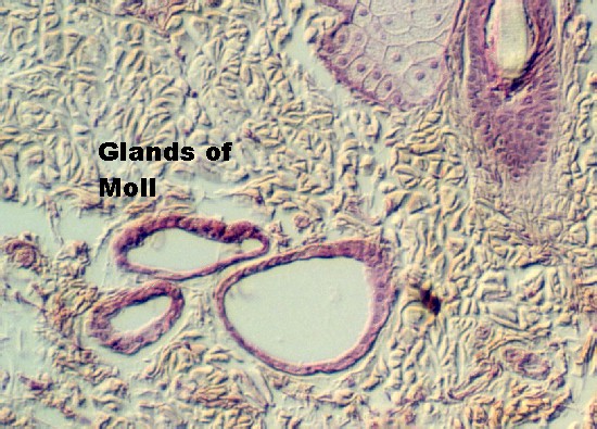 eyelid5.jpg (102688 bytes)