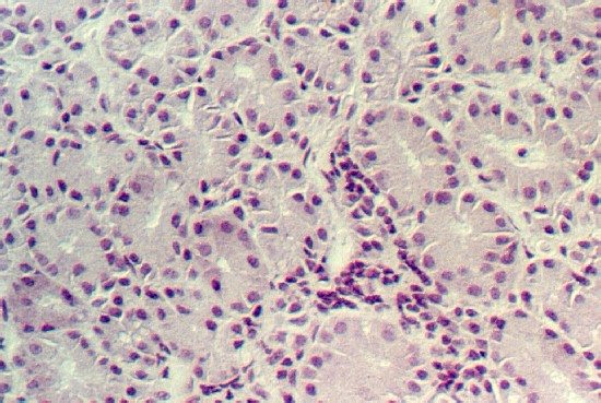 lacrimal.jpg (91811 bytes)