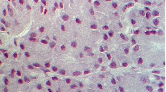 lacrimal2.jpg (58251 bytes)