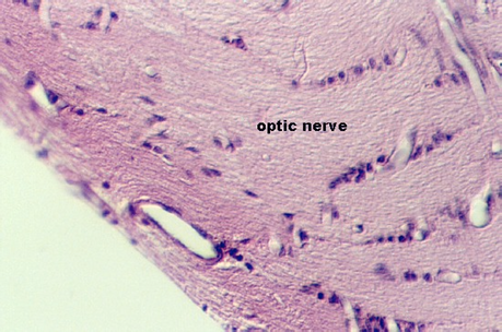 optic nerve2.jpg (79958 bytes)