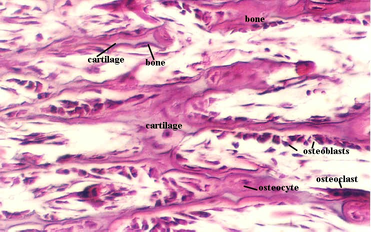 devbone1.jpg (123944 bytes)