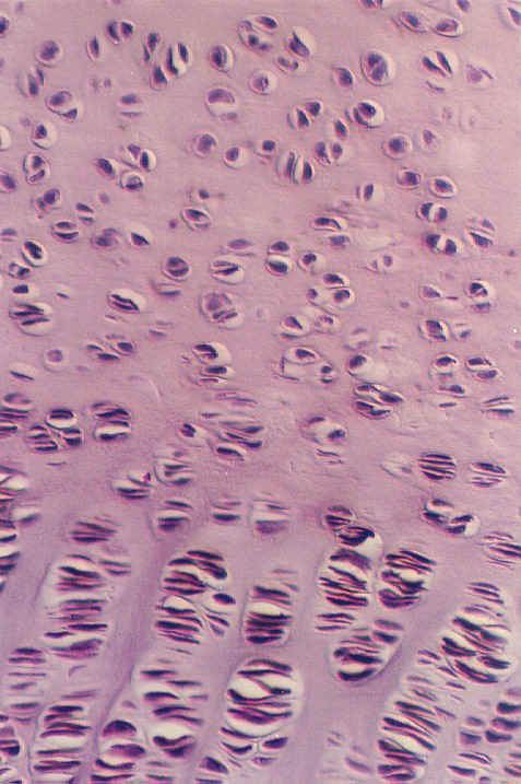 epiphysial2.jpg (111333 bytes)