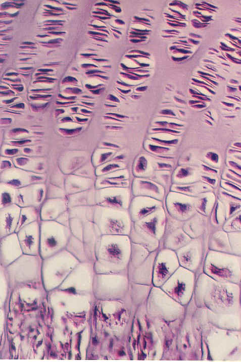 epiphysial3.jpg (120429 bytes)