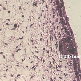 devtooth1.jpg (159567 bytes)