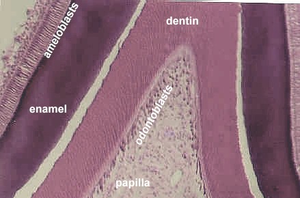 devtooth11.jpg (121120 bytes)