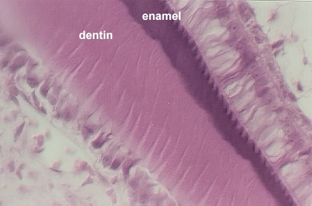 devtooth14.jpg (109551 bytes)