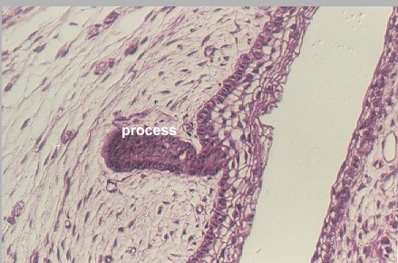 devtooth2.jpg (153866 bytes)