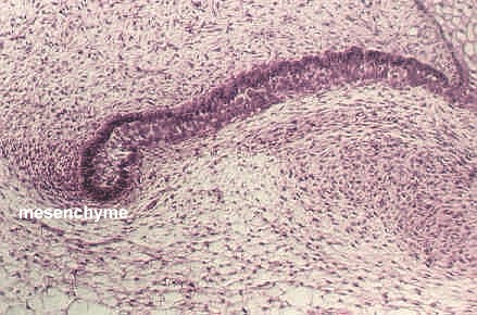 devtooth4.jpg (171283 bytes)