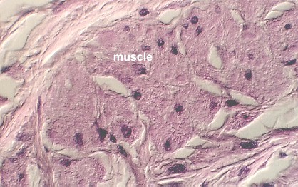 esophagus4.jpg (118878 bytes)