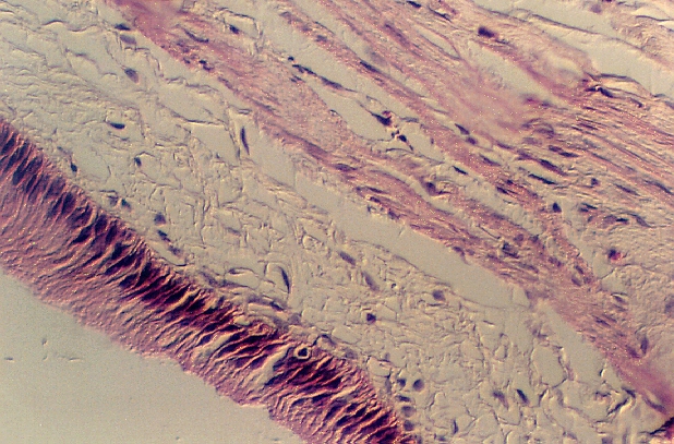 gall bladder1.jpg (305770 bytes)