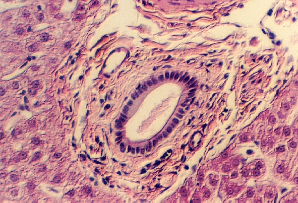 liver10.jpg (331570 bytes)