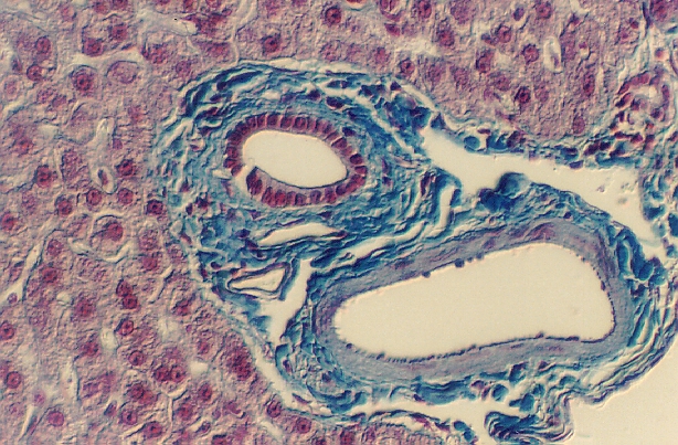 liver12.jpg (331834 bytes)