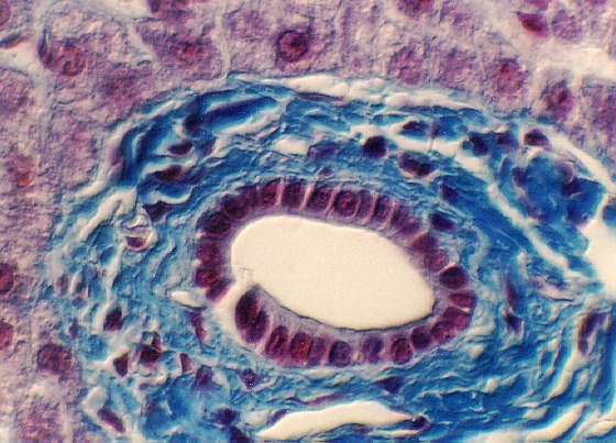 liver13.jpg (282803 bytes)