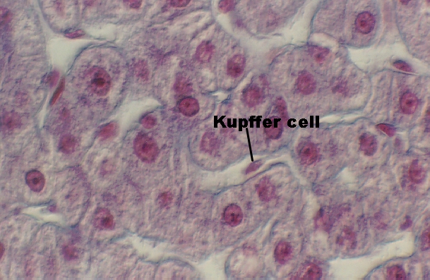 liver5.jpg (225966 bytes)