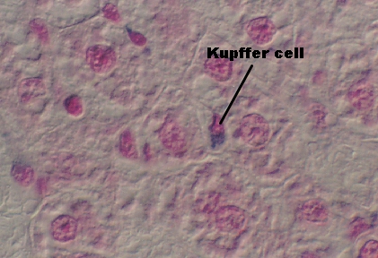 liver7.jpg (116700 bytes)