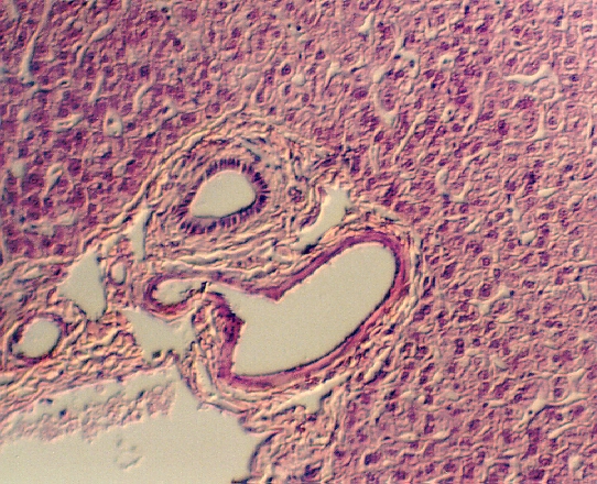 liver8.jpg (322732 bytes)