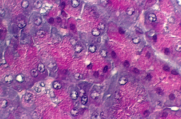 pancreas.jpg (292611 bytes)