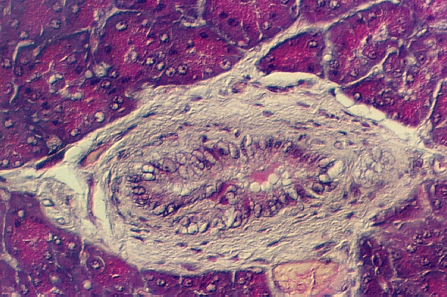 pancreas5.jpg (379615 bytes)