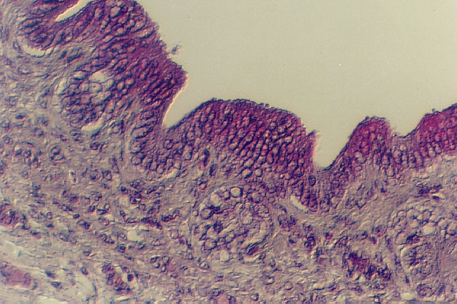 pancreas6.jpg (337981 bytes)