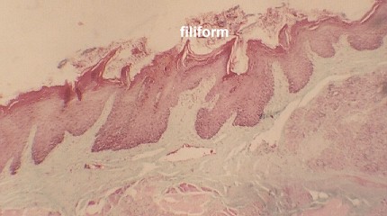 tongue2.jpg (93285 bytes)