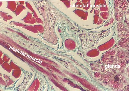 tongue4.jpg (155436 bytes)