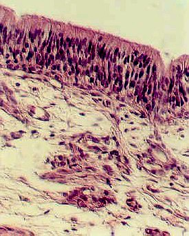 Olfactory2.jpg (55215 bytes)