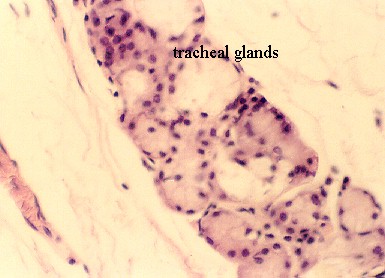 trachea2.jpg (32975 bytes)