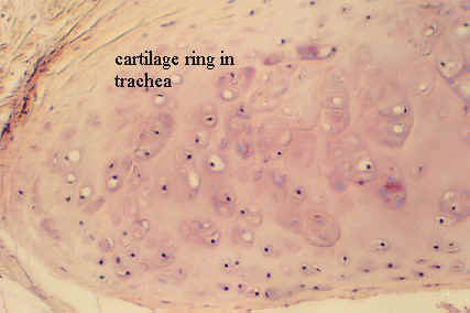 trachea4.jpg (33852 bytes)